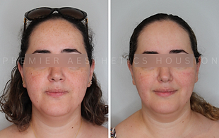 PREMIER AESTHETICS HOUSTON.png