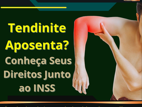 Tendinite Aposenta? Conheça Seus Direitos Junto ao INSS