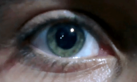 Nystagmus_eye_movement.gif