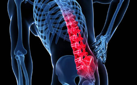 antalgia-acute-disc-injury.jpg