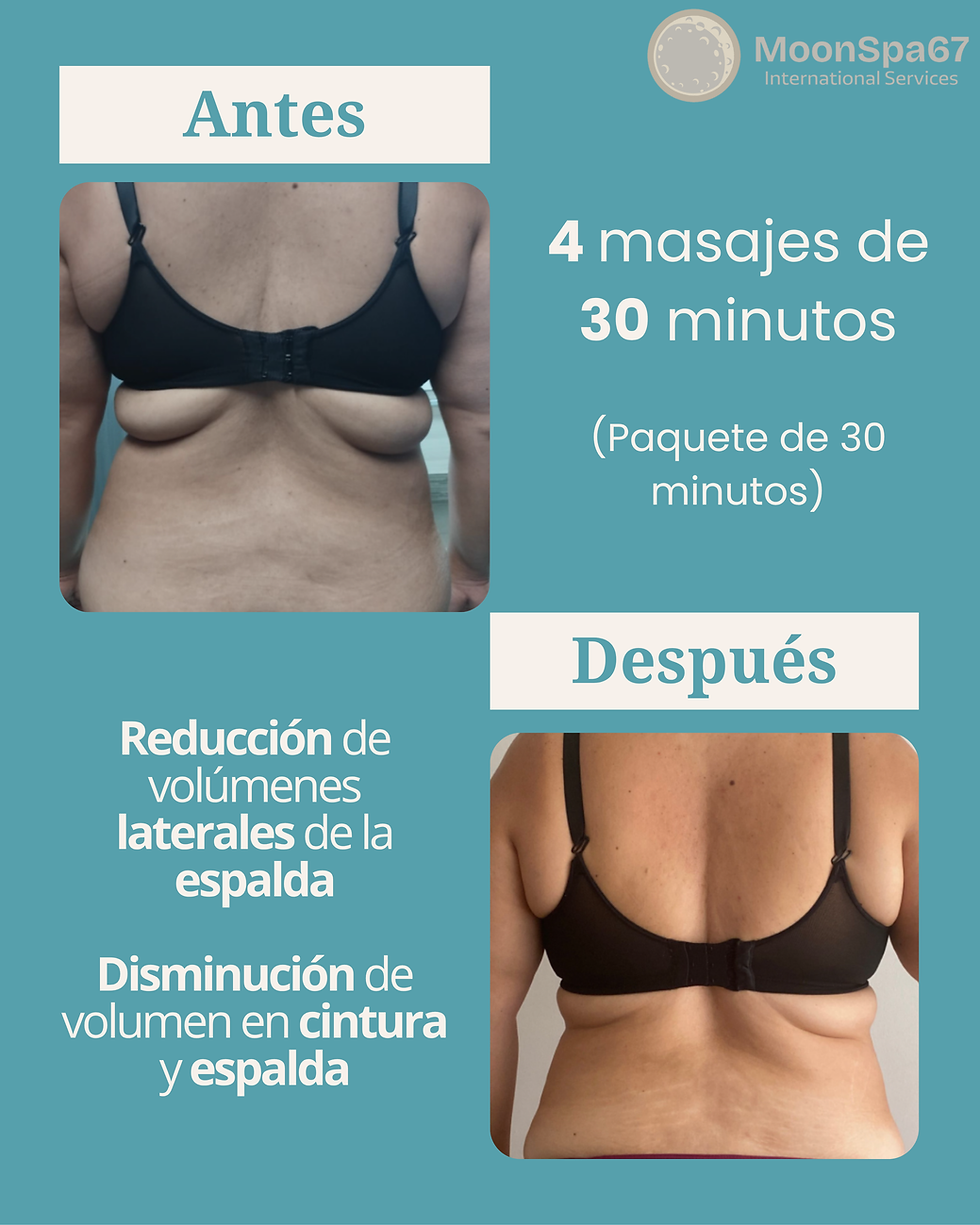 Espalda