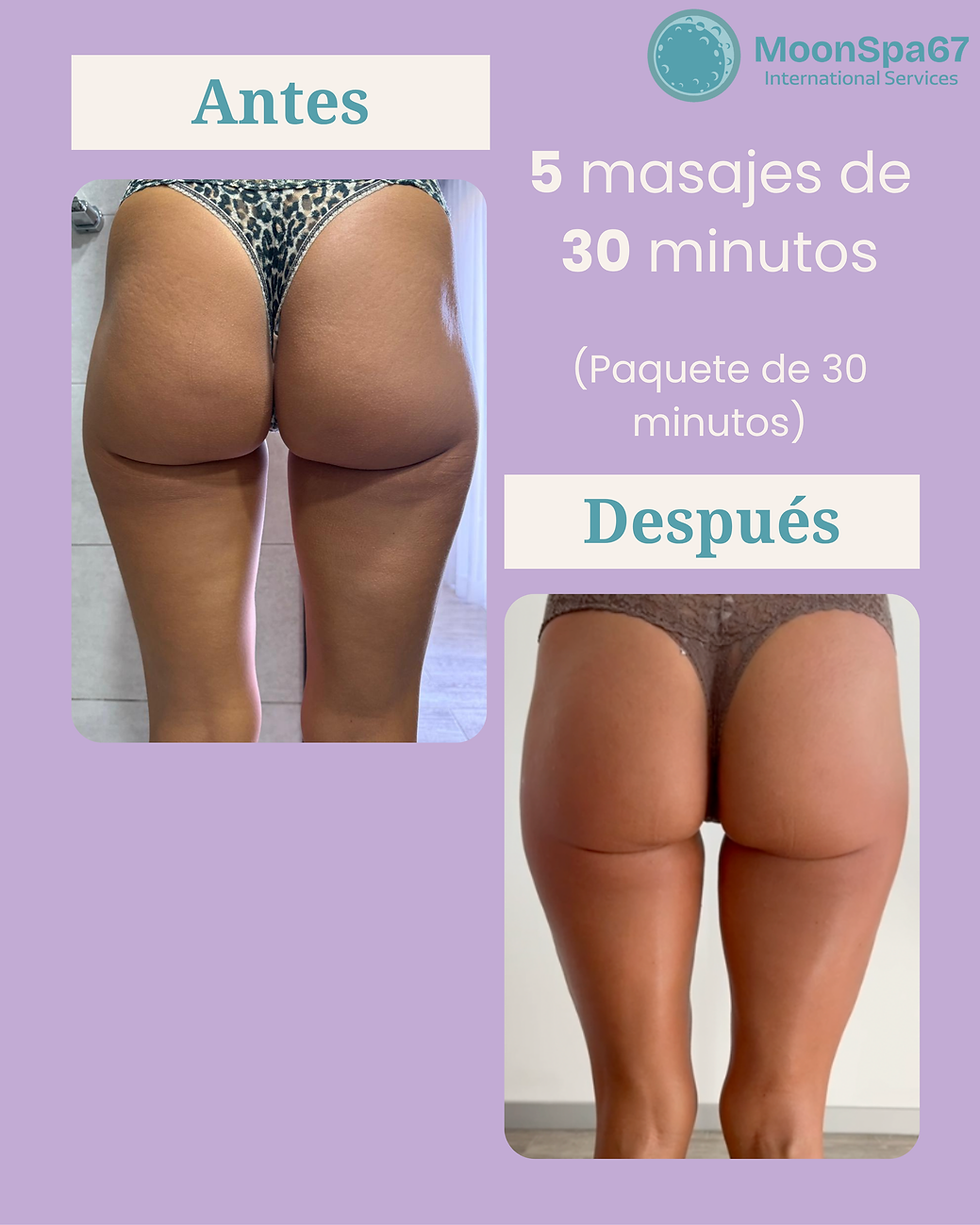 Glúteos