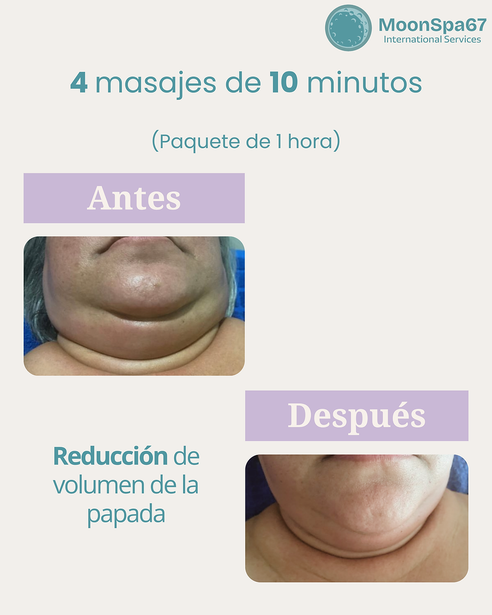 Papada
