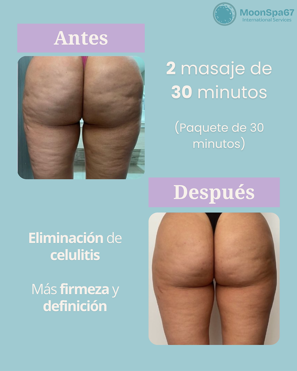 Glúteos