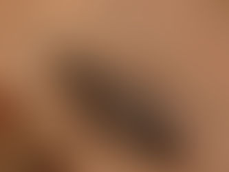 Diagnóstico e tratamento de Chagas passam pela Atenção Primária à Saúde