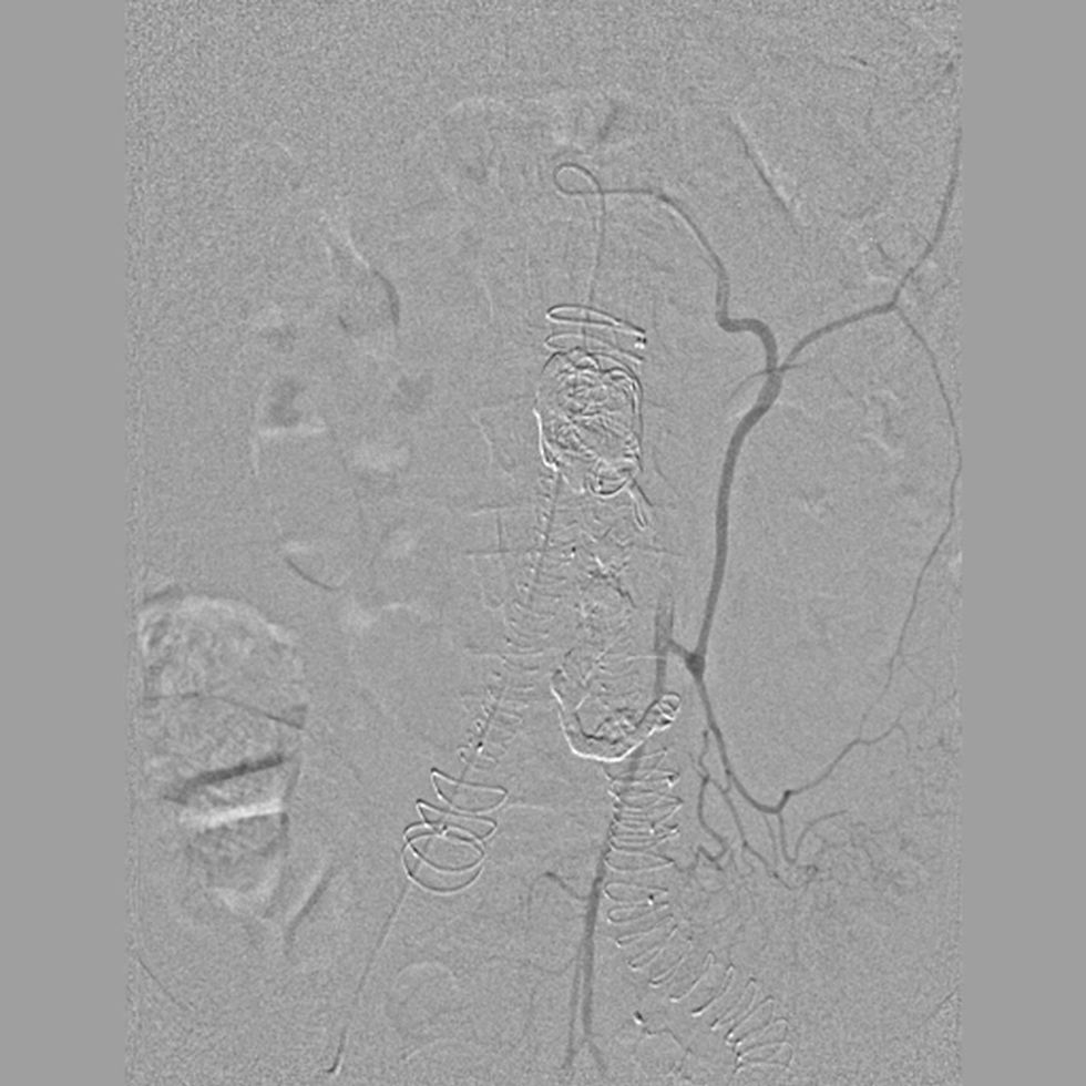 radiografia diagnostica PAE