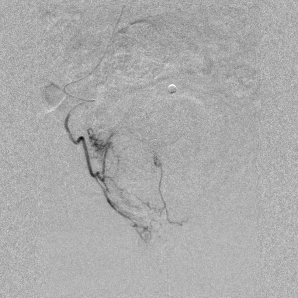 radiografia diagnostica PAE