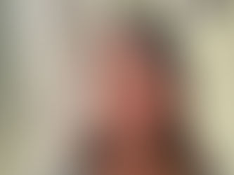 Every Time I Fell Asleep, My Body Fired an Alarm: Holly’s Story