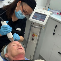 Infini RF needling Erin @ Bloom skin & Ma