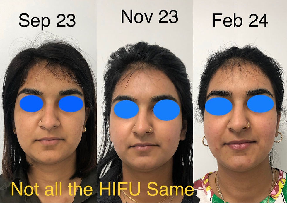 Ultraformer HIFU @ Bloom Skin & Massage