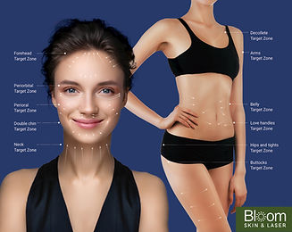 Skin and body treatment at Bloom Skin and Laser