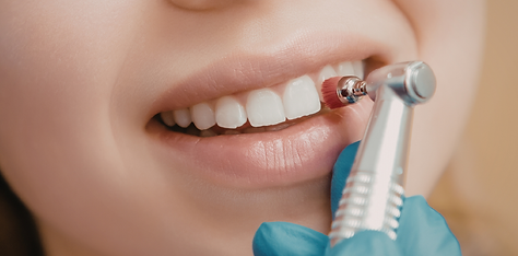 Dental Cleaning Hero Image.png