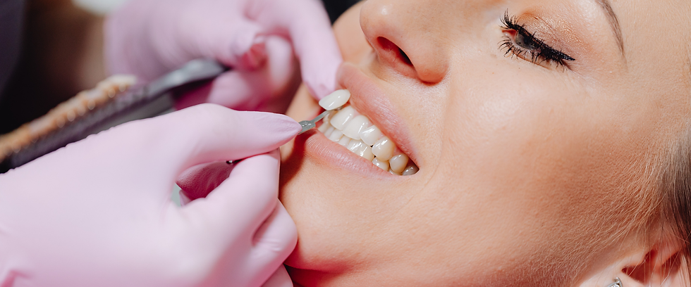 Porcelain Veneers Hero Image.png