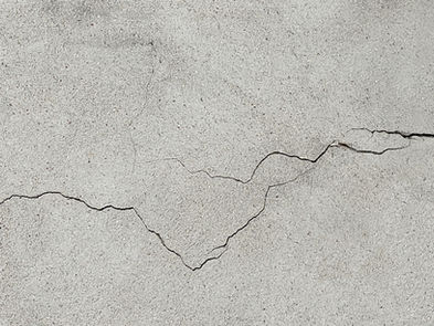 Acupuncture for Back and Neck Pain