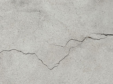 Acupuncture for Back and Neck Pain