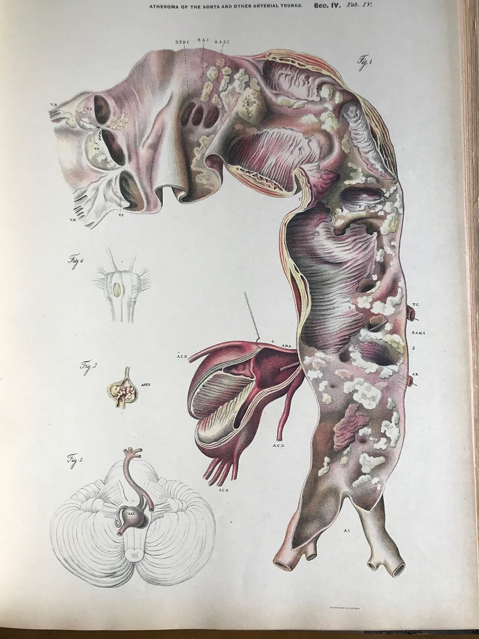 Thumbnail: Jeancon, Pathological Anatomy, 1885