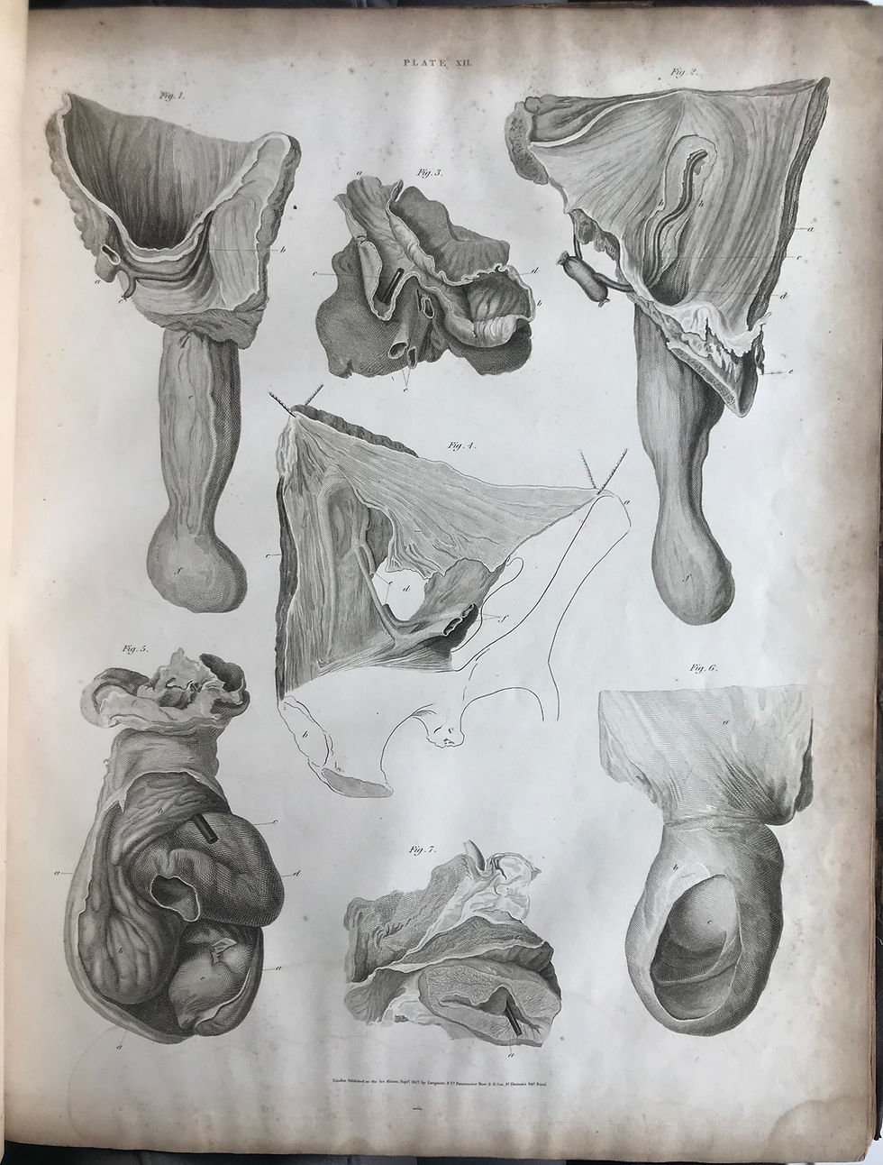 Thumbnail: Cooper, Hernia, 1827, inscribed by Bransby Cooper