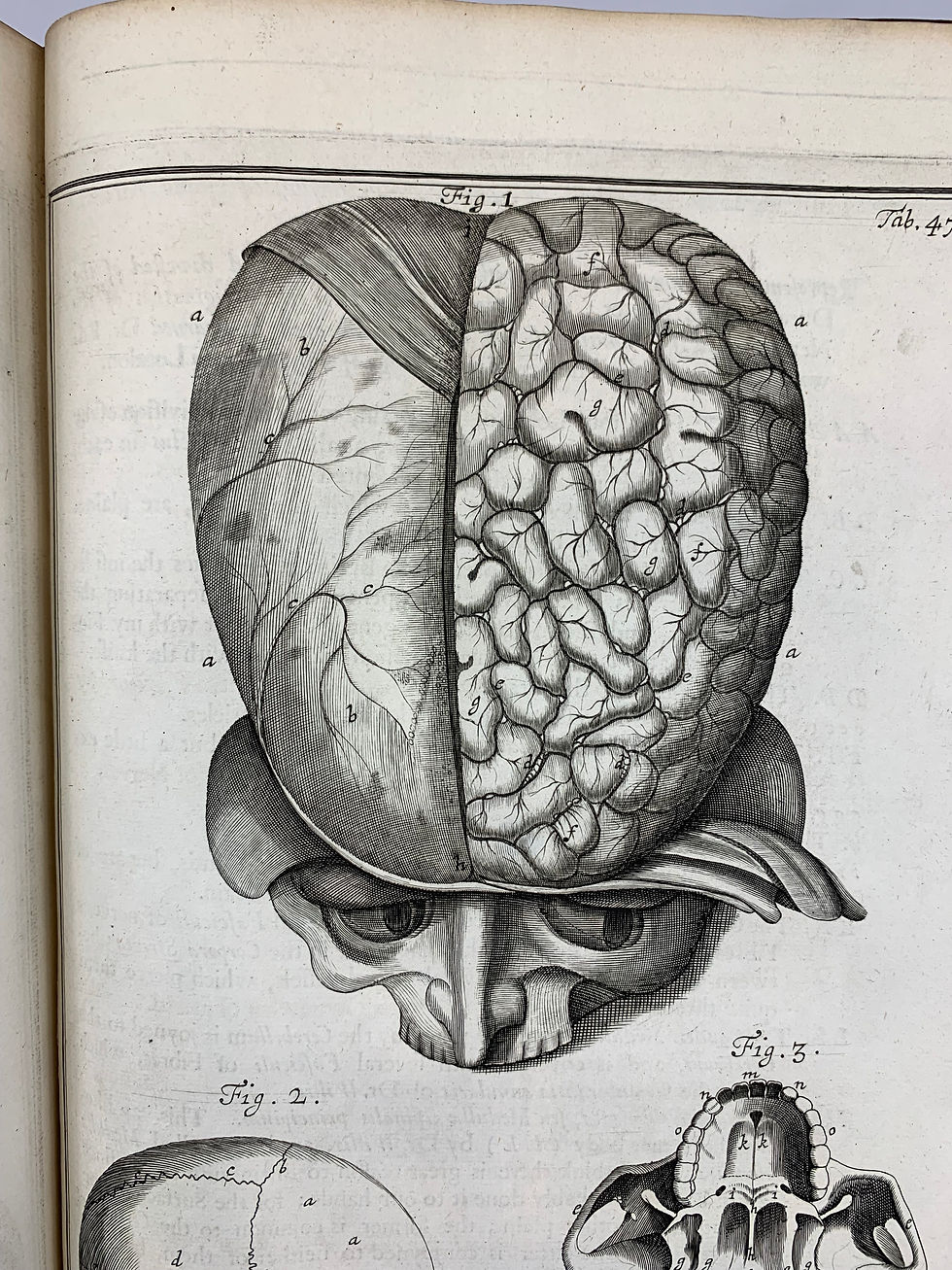 Thumbnail: Collins, Systeme of Anatomy, 1685