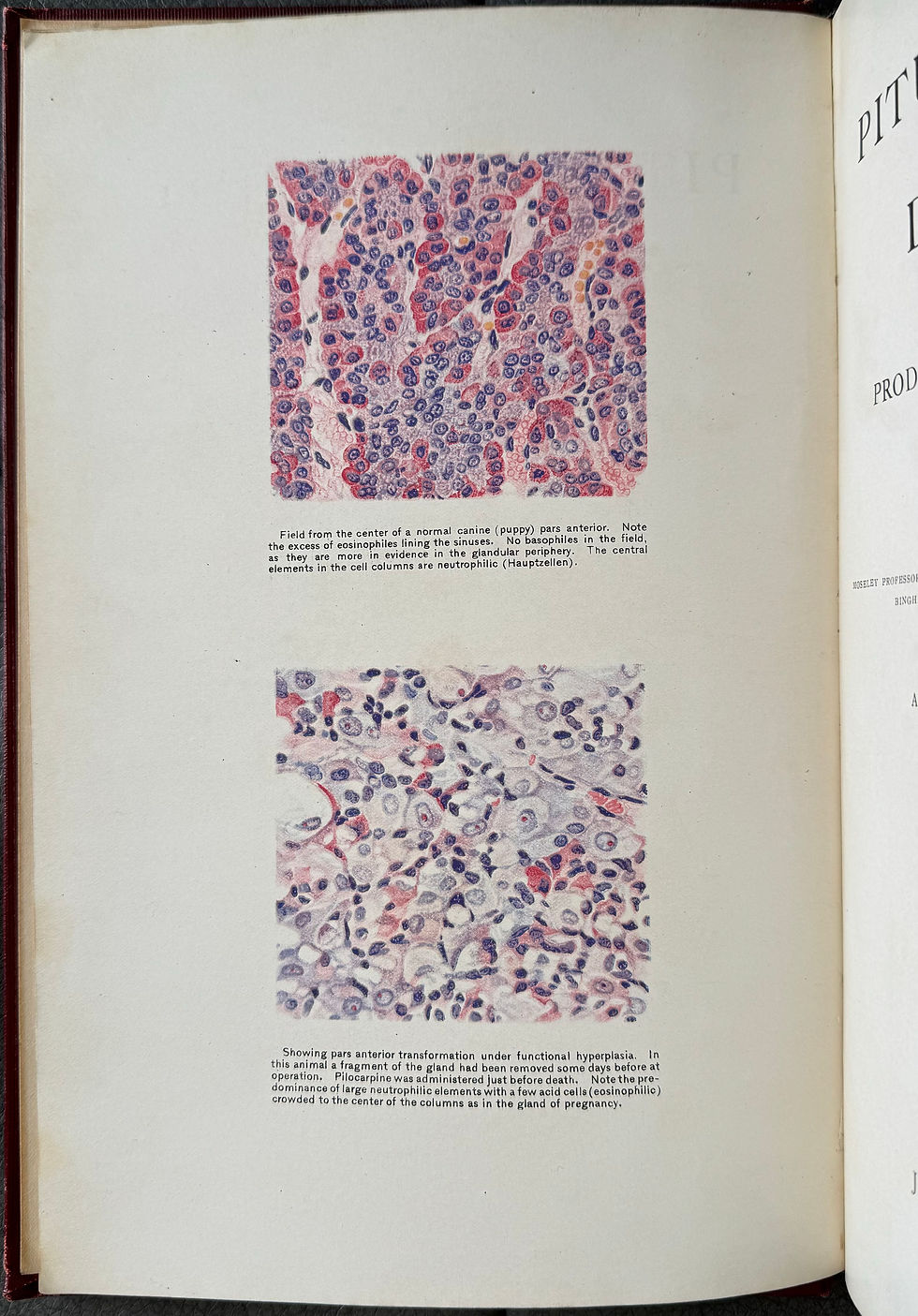 Thumbnail: Cushing, Pituitary Body and its Disorders, 1912