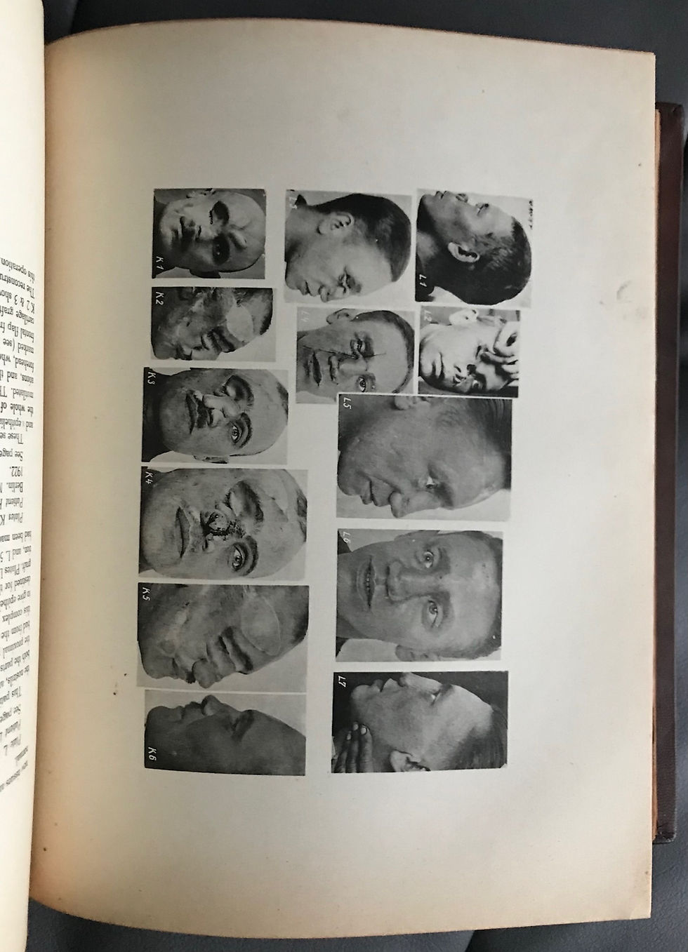 Thumbnail: Esser, Biological Flaps, circa 1928