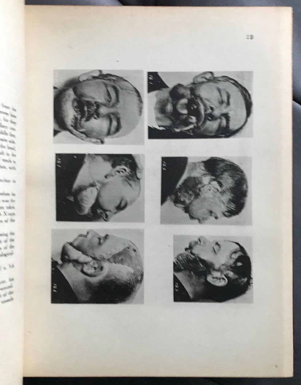 Thumbnail: Esser, Biological Flaps, circa 1928