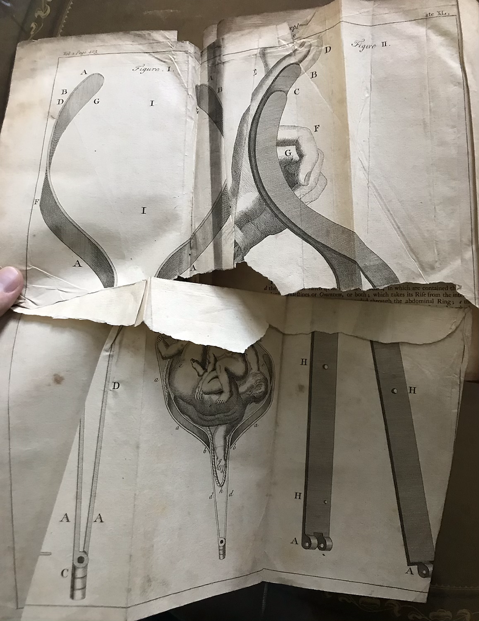 Thumbnail: Heister General System of Surgery 1757