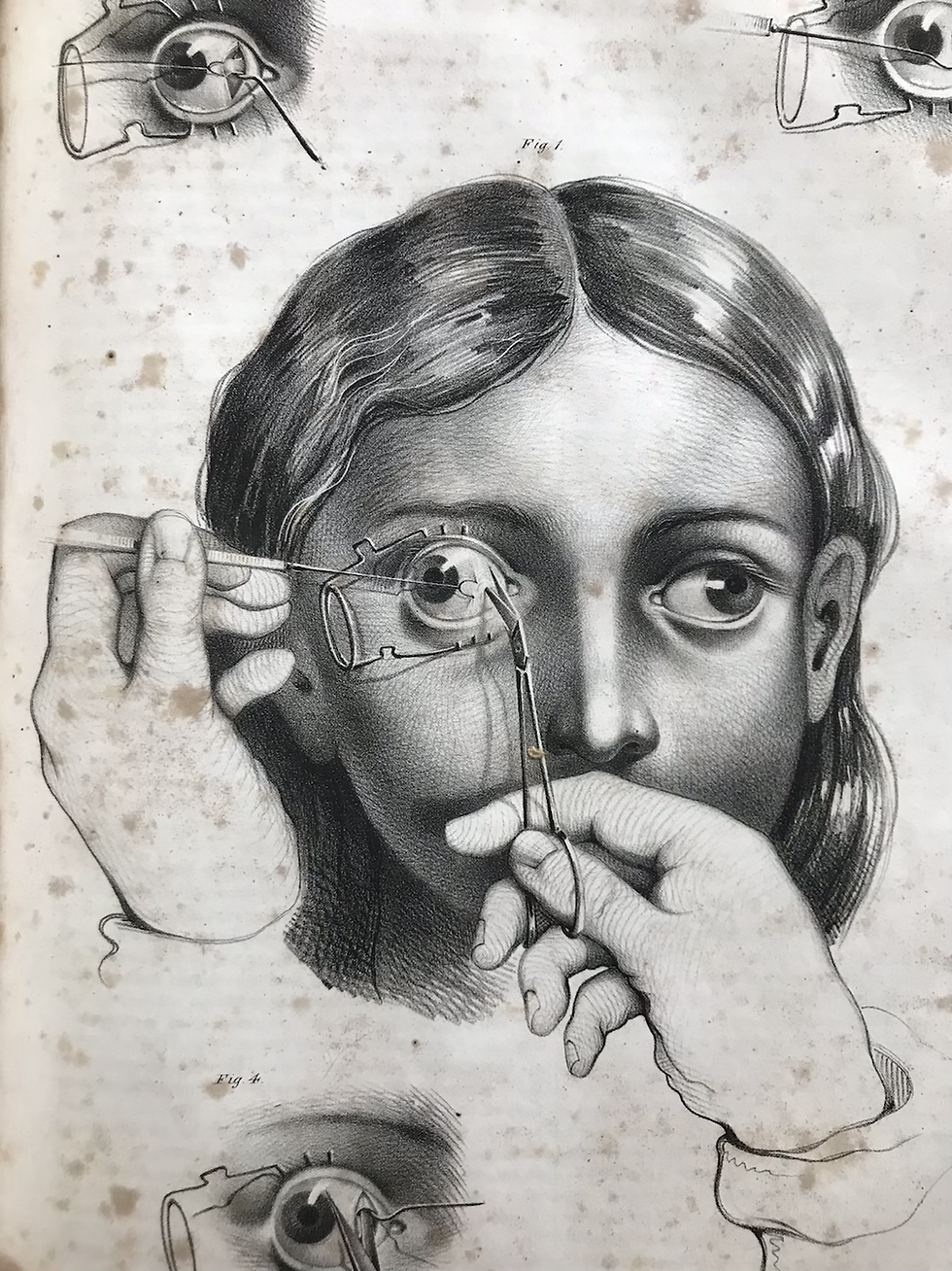 Thumbnail: Pancoast Operative Surgery 1844