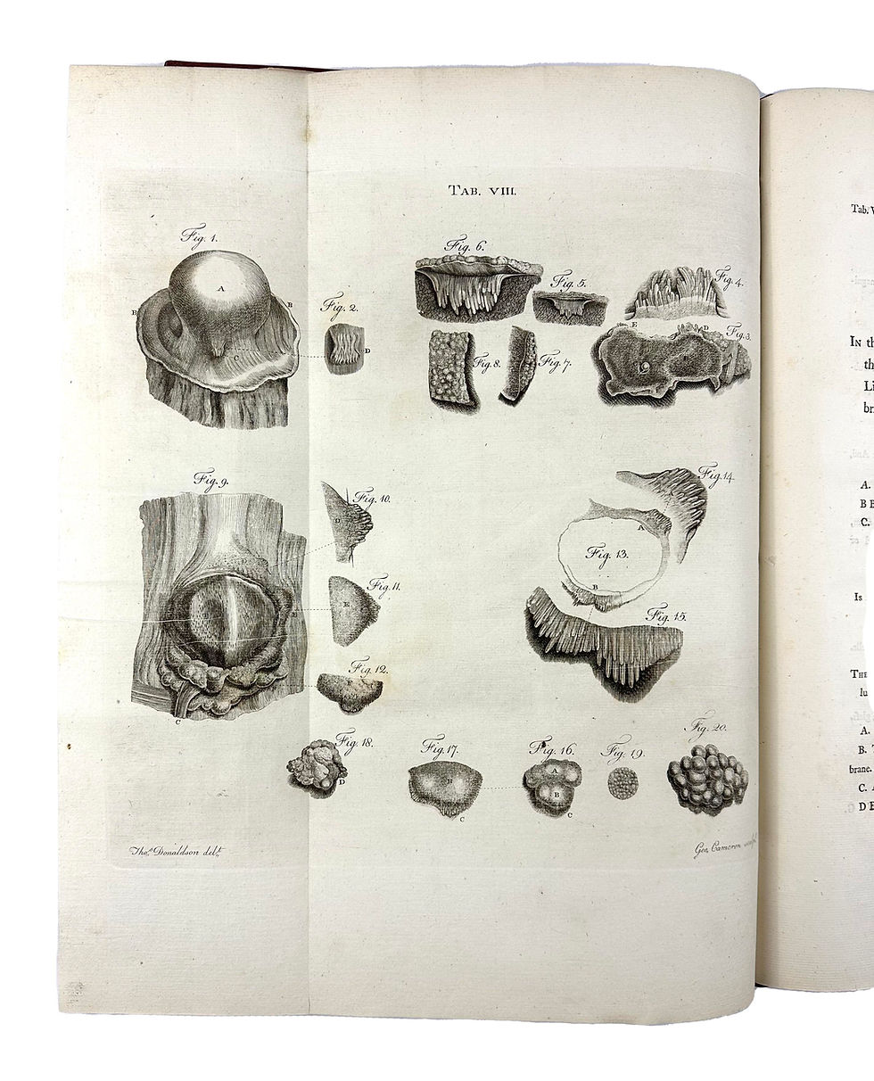 Thumbnail: Monro, Bursae Mucosae, 1788