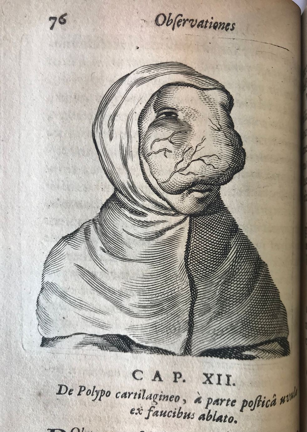 Thumbnail: Meek'ren Chirurgi Amstelodamensis Observationes Medico-Chirurgicae 1682