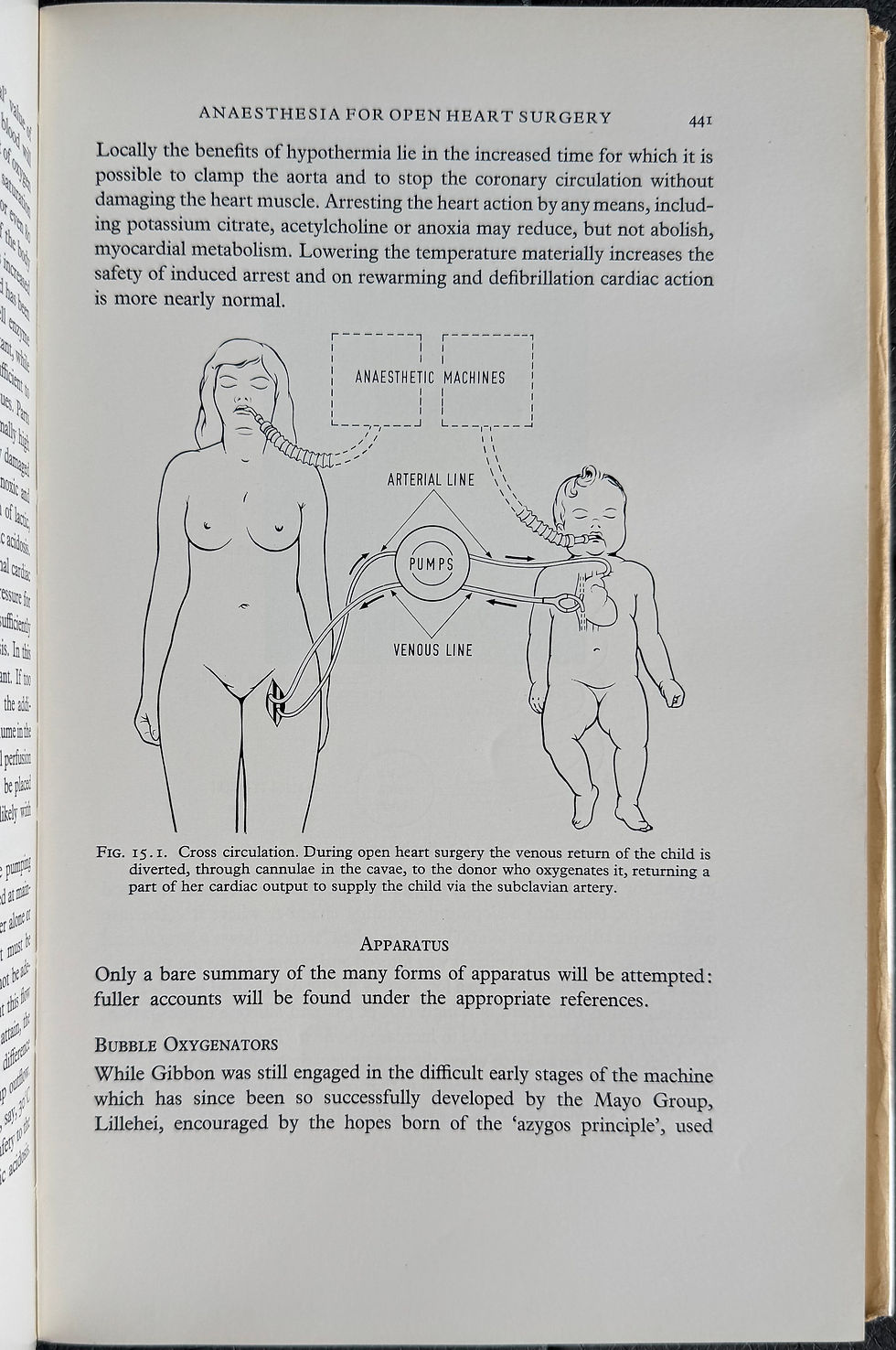 Thumbnail: Mushin, Thoracic Anaesthesia, 1963 (inscribed copy)