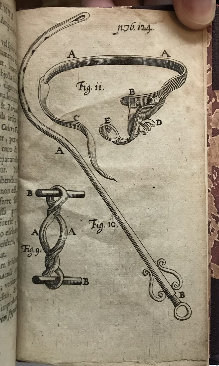 Thumbnail: Nuck Operationes and Experimenta Chirurgica 1698