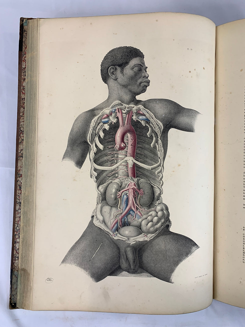 Thumbnail: Maclise, Surgical Anatomy, 1851