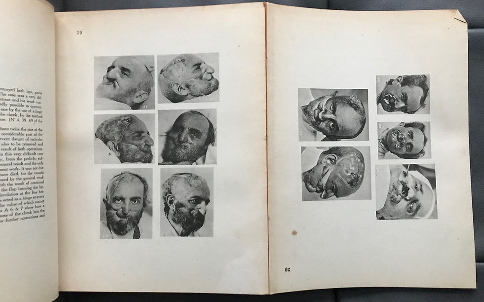 Thumbnail: Esser, Biological Flaps, circa 1928