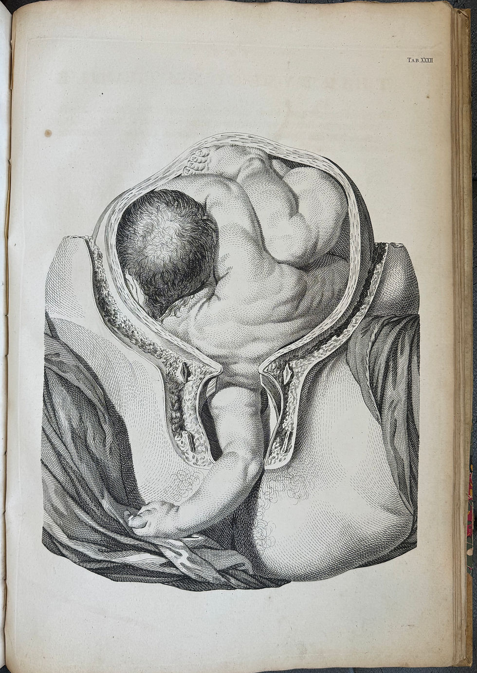 Thumbnail: Smellie, A Sett of Anatomical Tables (on midwifery), First ed, 1754