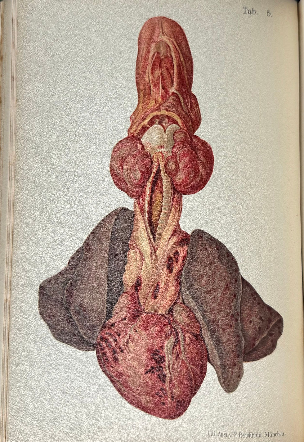 Thumbnail: Hofmann,  Atlas der Gerichtlichen Medizin, 1898 (first edition)
