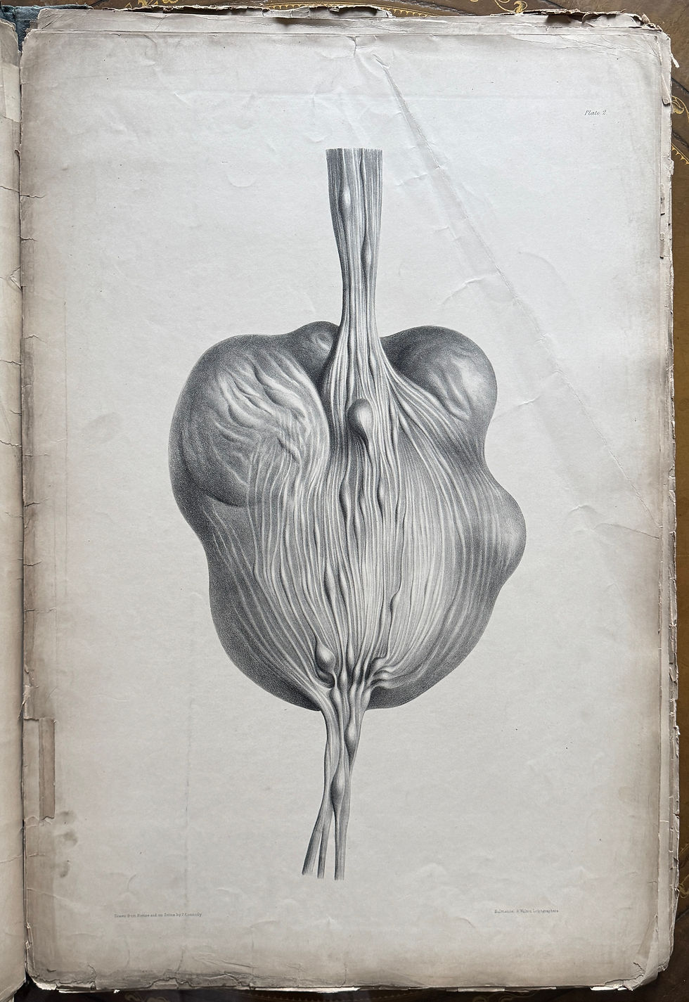 Thumbnail: Smith, Treatise on Neuroma, 1849