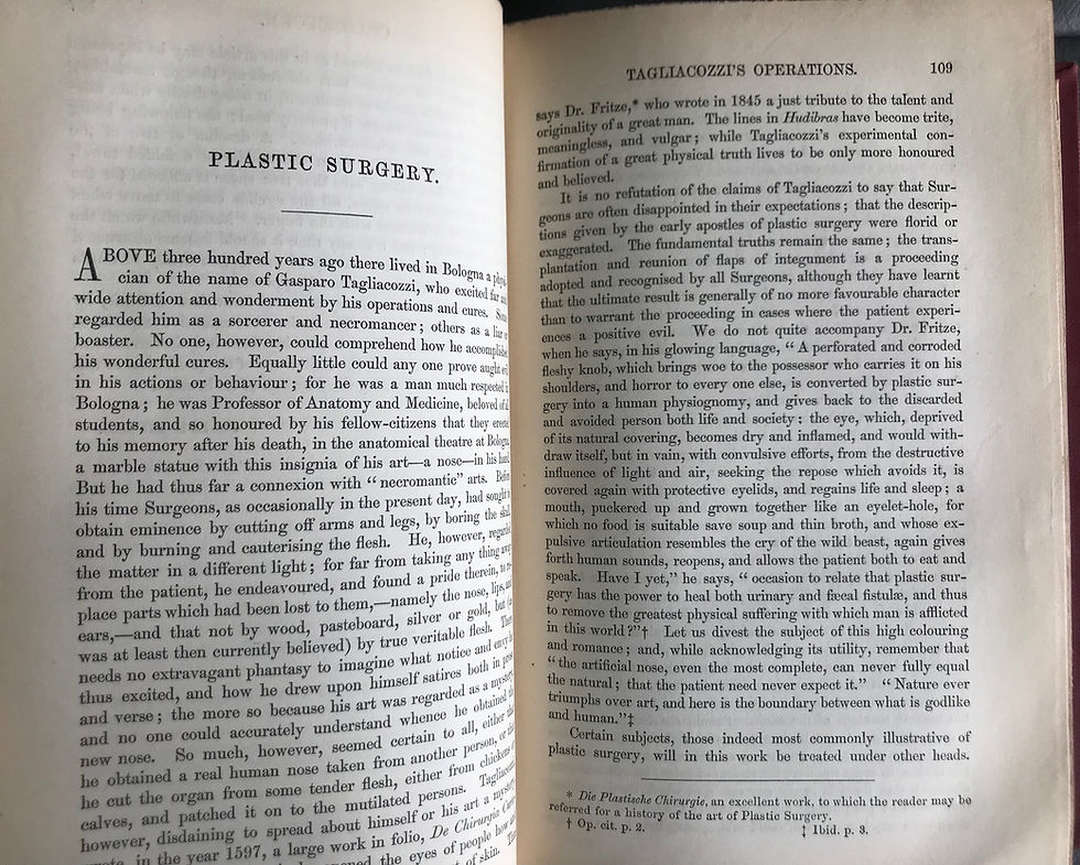 Thumbnail: Holmes' System of Surgery, first edition, 1860-1864, in four volumes