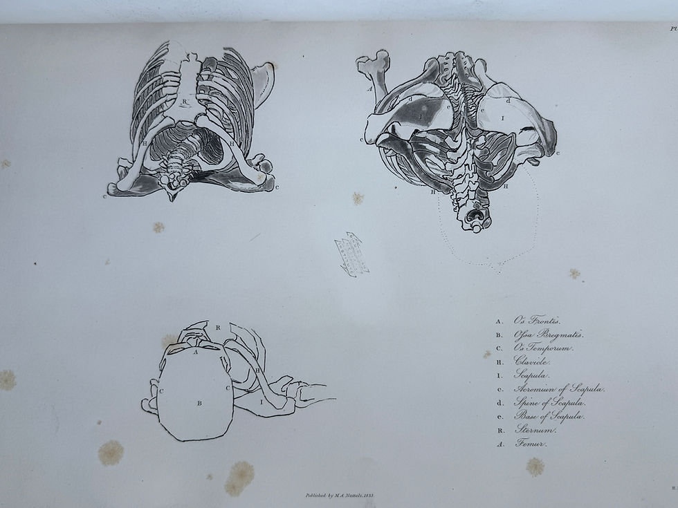 Thumbnail: Flaxman, Anatomical Studies, 1833