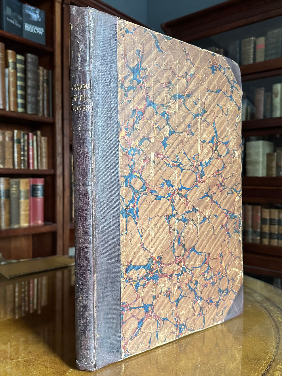 Cheselden, Osteographia, undated variant (1733), Mouteir’s copy