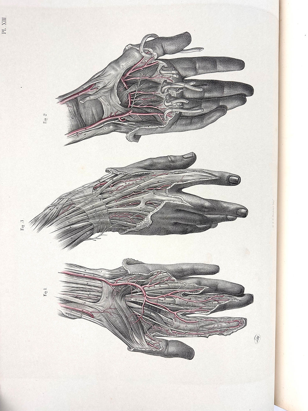 Thumbnail: Maclise, Surgical Anatomy, 1856