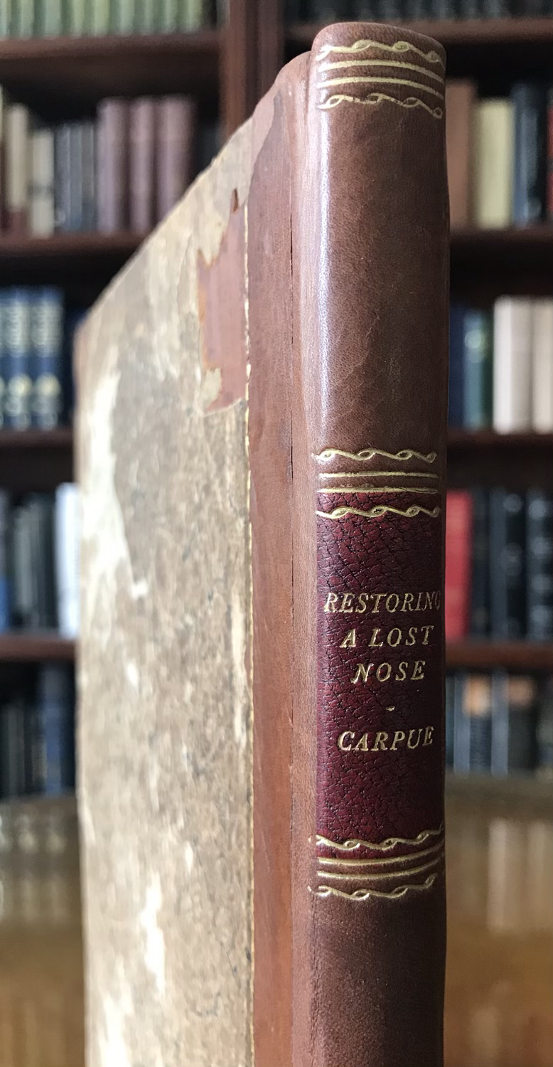Thumbnail: Carpue, Restoring a Lost Nose, 1816