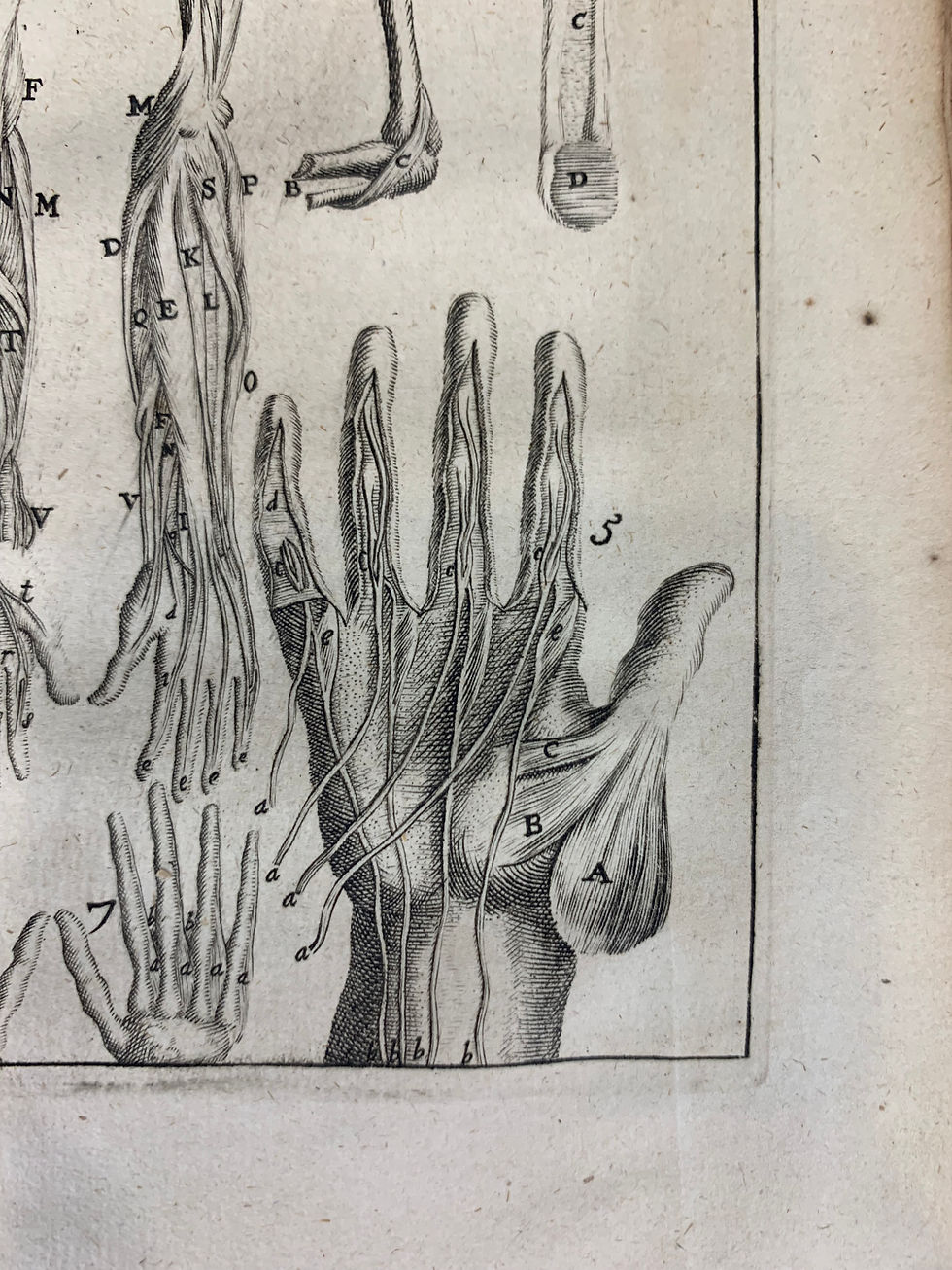 Thumbnail: Verheyen, Corporis Humani Anatomaie WITH Supplementum Anatomicum, 2nd ed, 1710