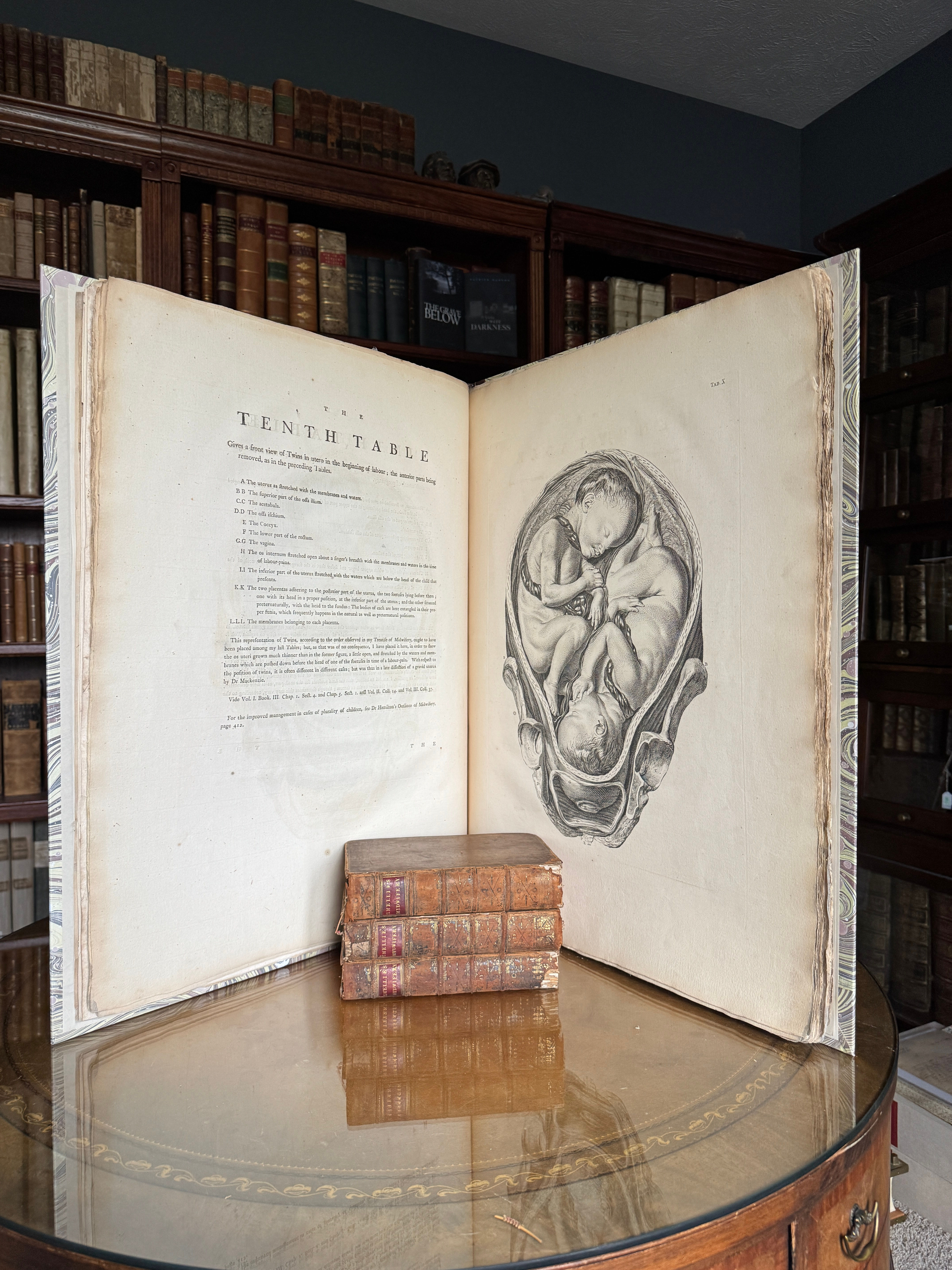 Smellie, text and atlas on midwifery, 4 vol, 1762 - 1787