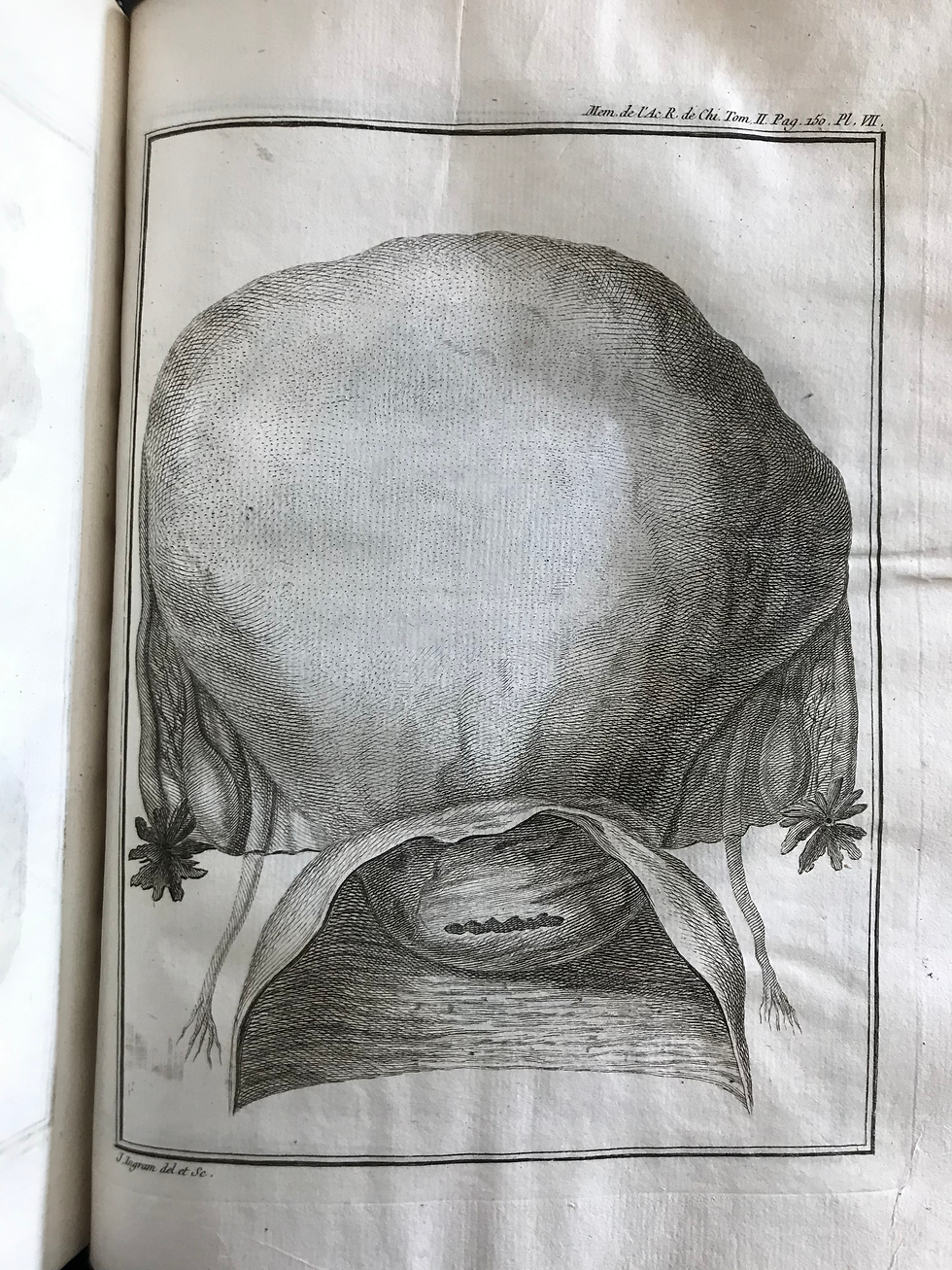 Thumbnail: Memoires de L’Academie Royale de Chirurgie. Tome Second. 1753