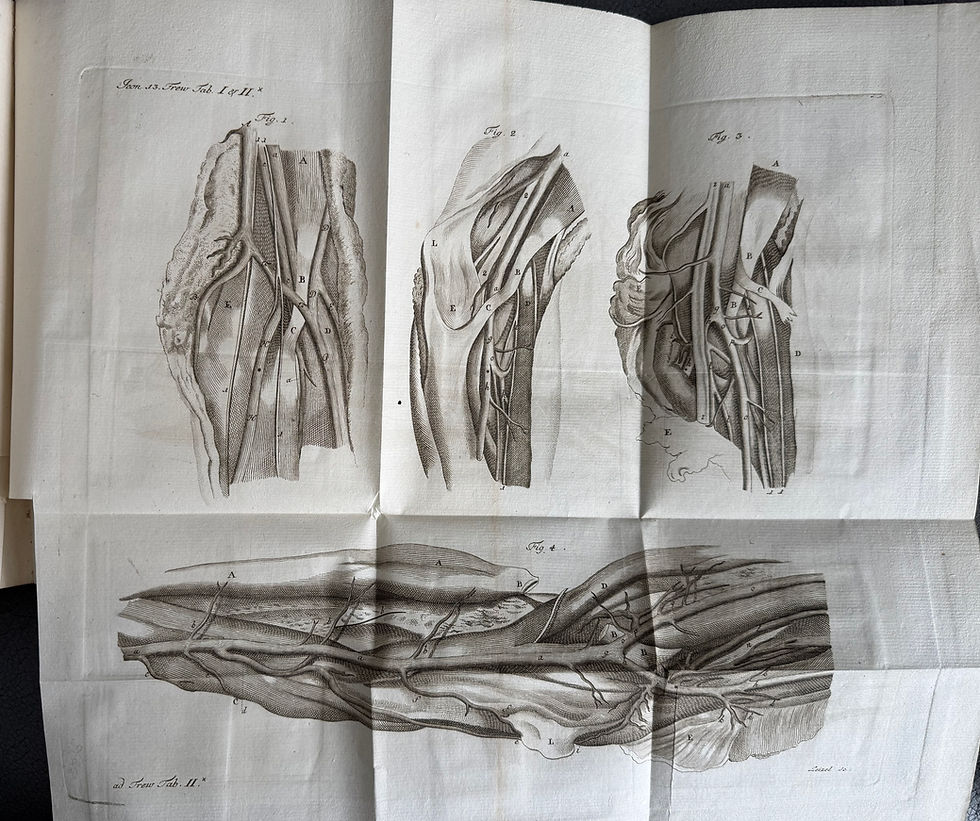 Thumbnail: Lauth, Aneurysmatibus Collectio, 1785