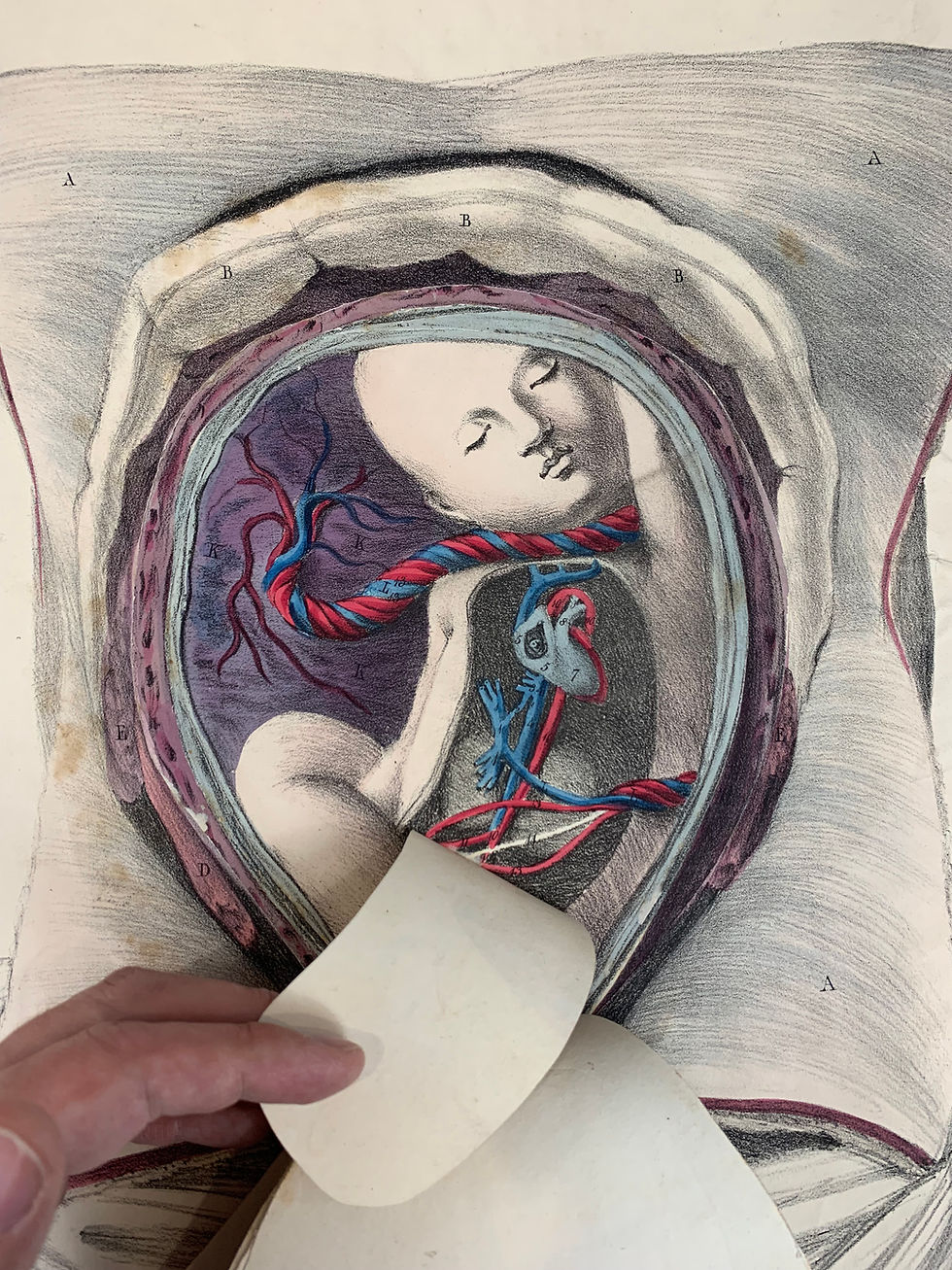 Thumbnail: Tuson, Myology (1825) and Supplement to Myology (1828)