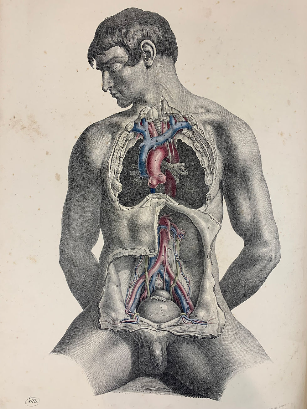 Thumbnail: Maclise, Surgical Anatomy, 1851