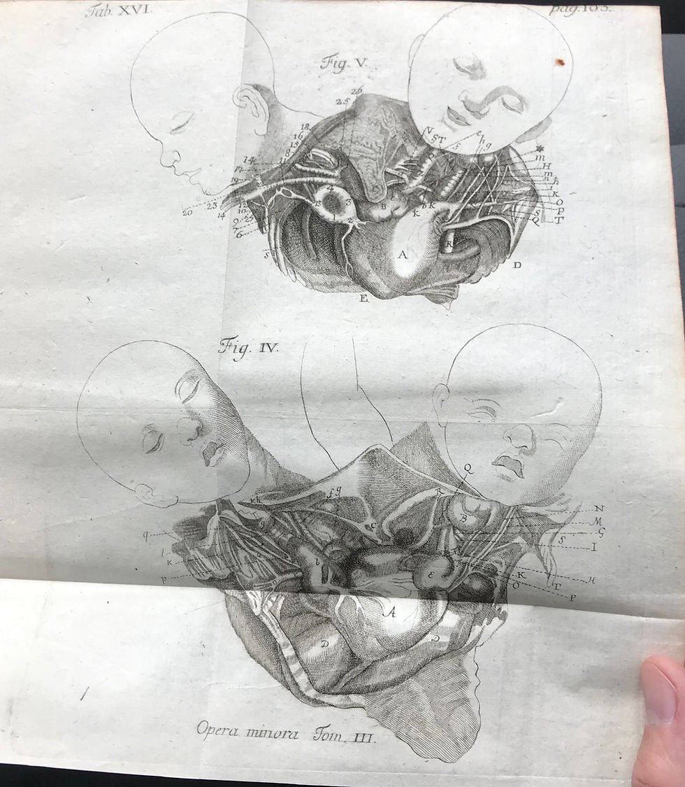Thumbnail: HALLER, Opera Minora, 1762-1768
