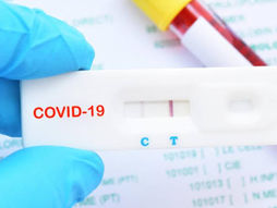 Sud-kivu : Le gouvernement provincial supprime le paiement des frais test Covid-19 aux frontières.