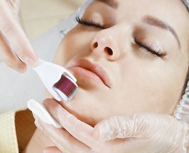 Dermaroller Rosa Garden Beauty Clinic